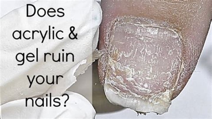 Are acrylic bad for your nails?