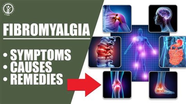Are cfs and fibromyalgia the same?