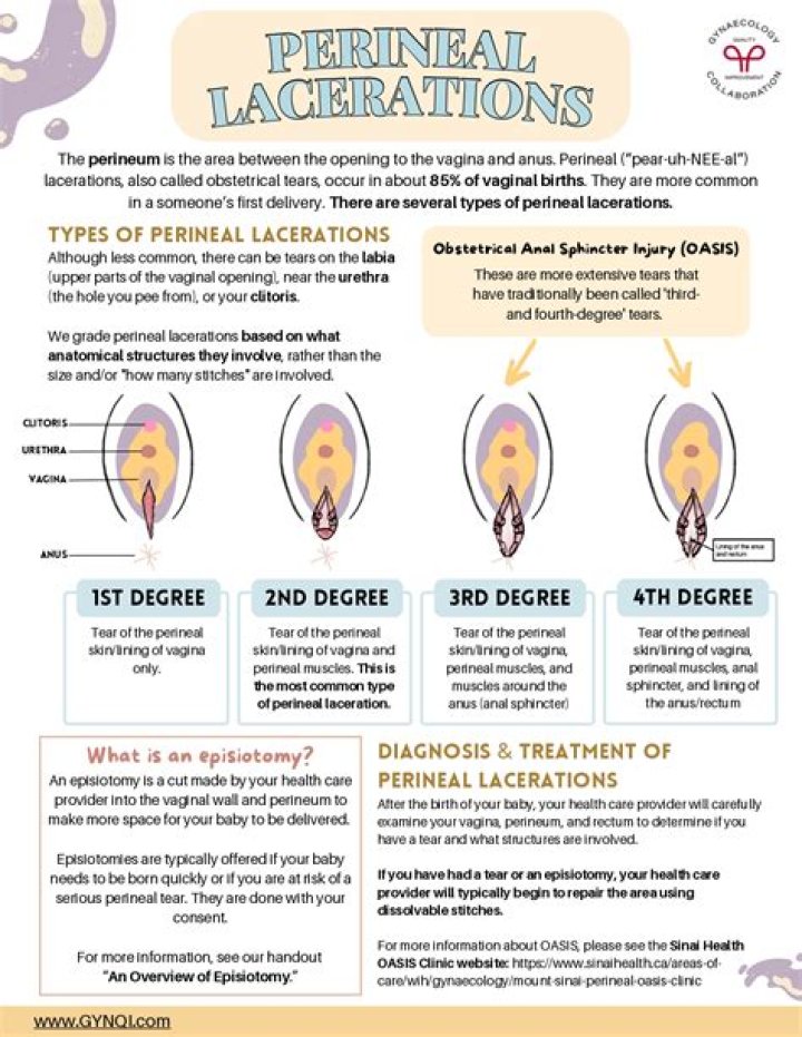 Are perineal tears common?