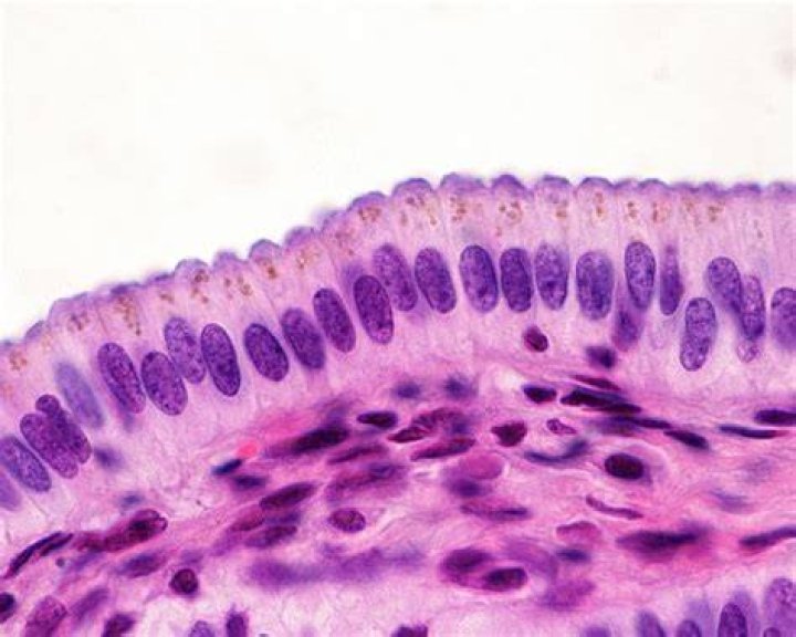 Are simple columnar epithelium?