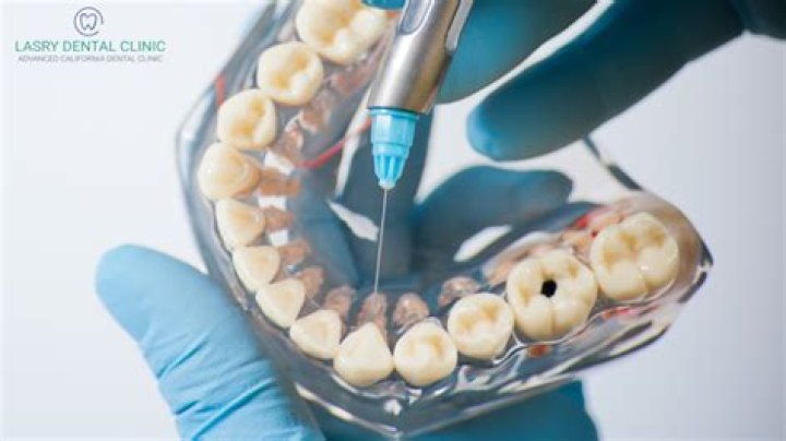 Are you given anesthesia for wisdom teeth?