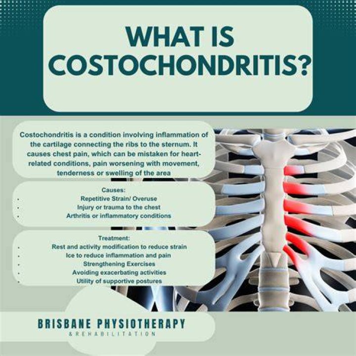 Can anxiety cause costochondritis?