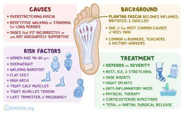 Can pes cavus cause plantar fasciitis?
