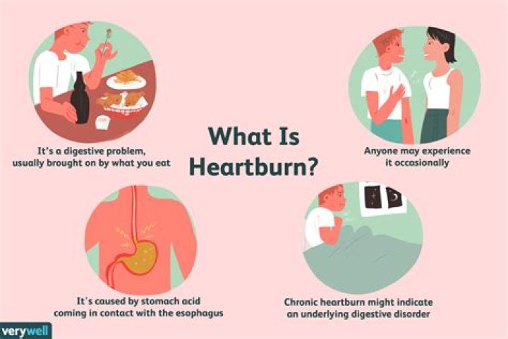 Can soda cause heartburn?