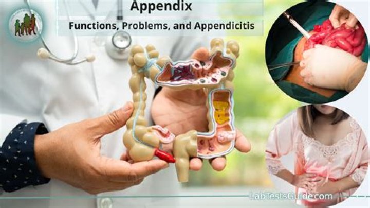 Can you die from an exploded appendix?