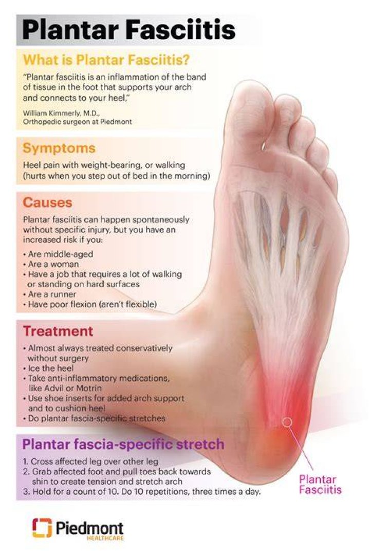 Could plantar fasciitis be something else?