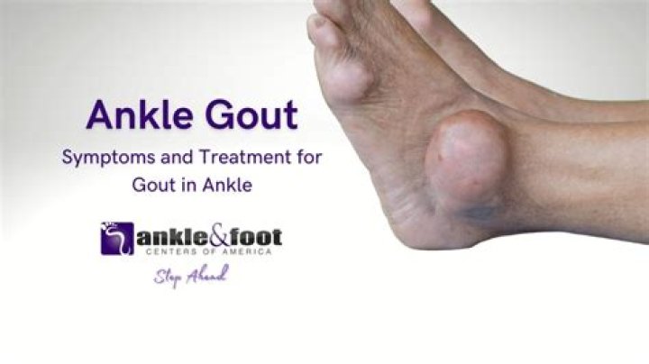 Could swollen ankle be gout?
