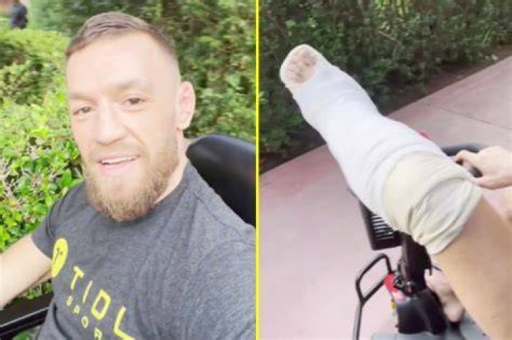 Did conor mcgregor tear his acl?