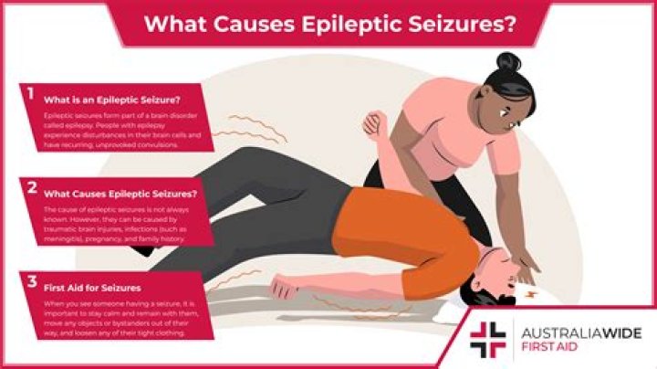Do all seizures cause shaking?