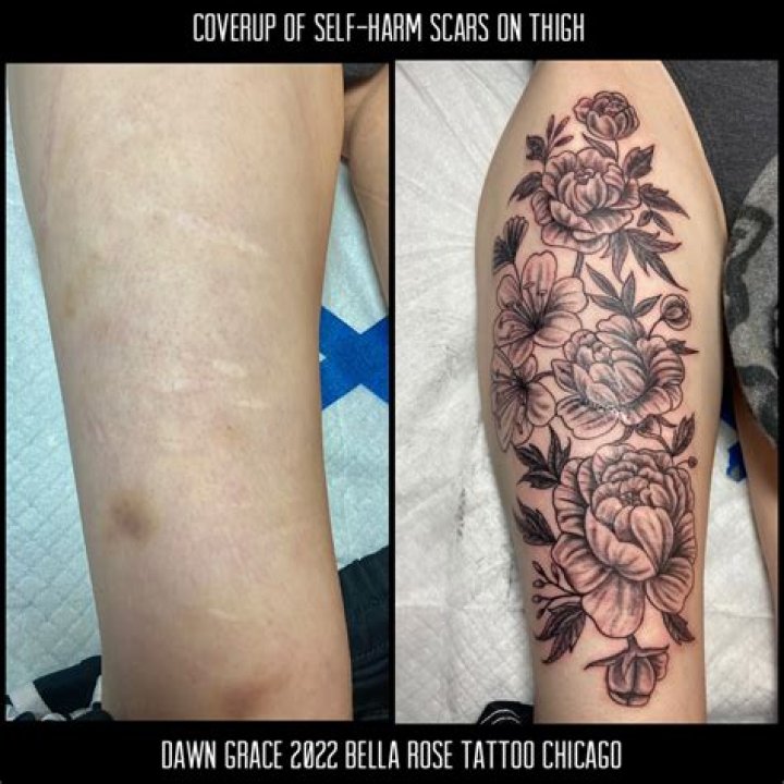 Does a cover up tattoo hurt more?