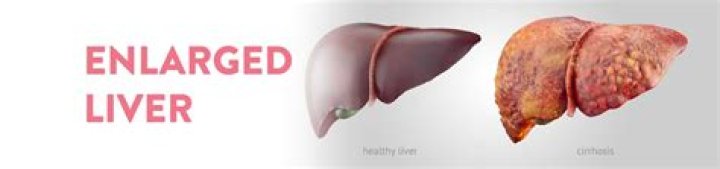 Does liver grows back?