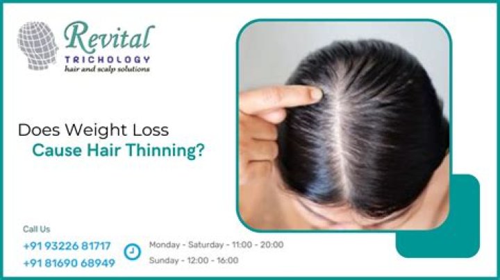Does weight loss cause hair loss?