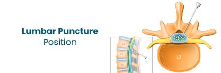 For what is a lumbar puncture used?