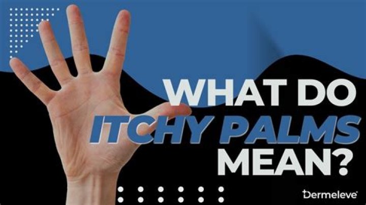Has an itching palm?
