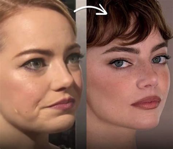 Has kyle had a facelift?