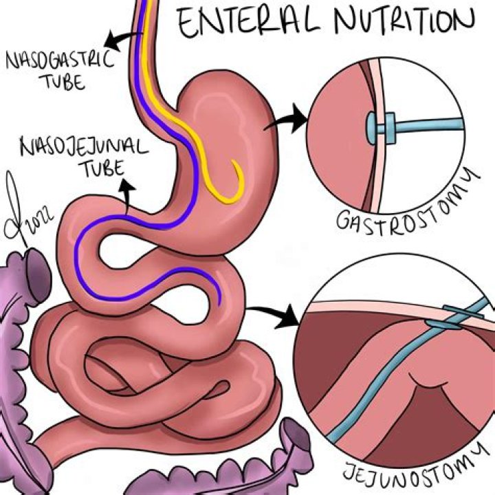How do you say duodenojejunostomy?