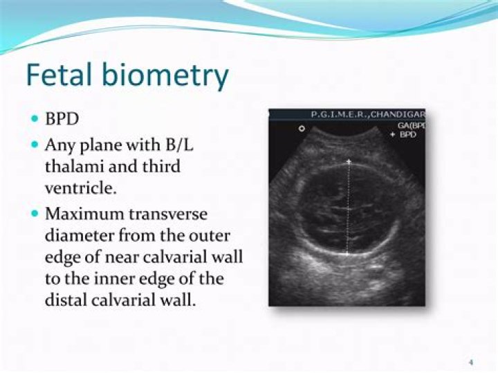 In fetal biometry what is bpd?