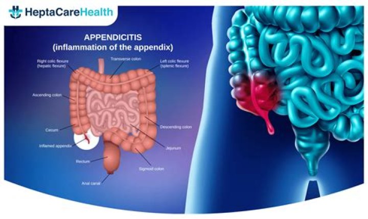 Is diarrhea normal after appendectomy?