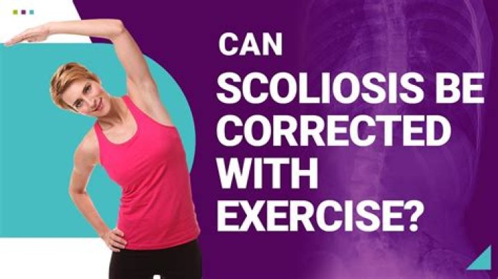 Is exercises bad for scoliosis?