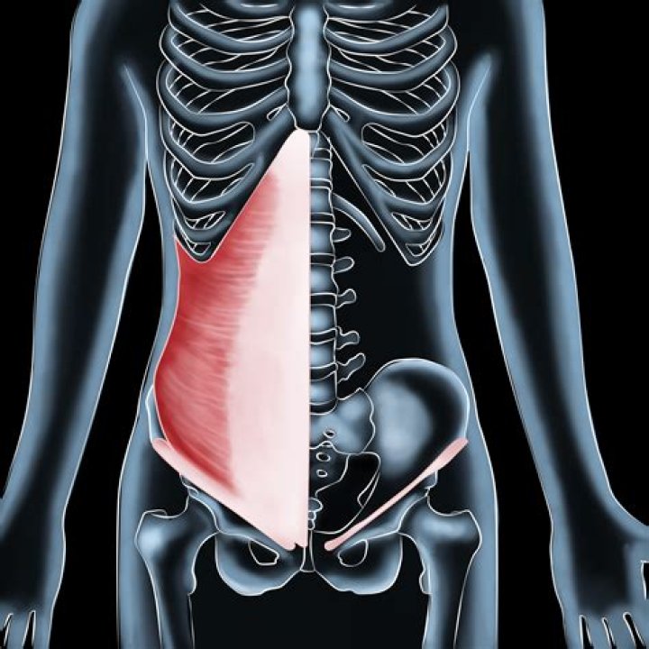 Is it transversus abdominis?