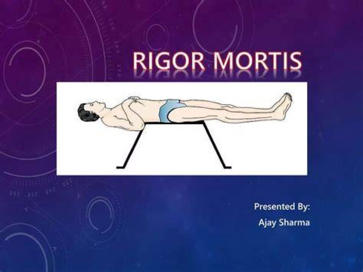 On set of rigor mortis?
