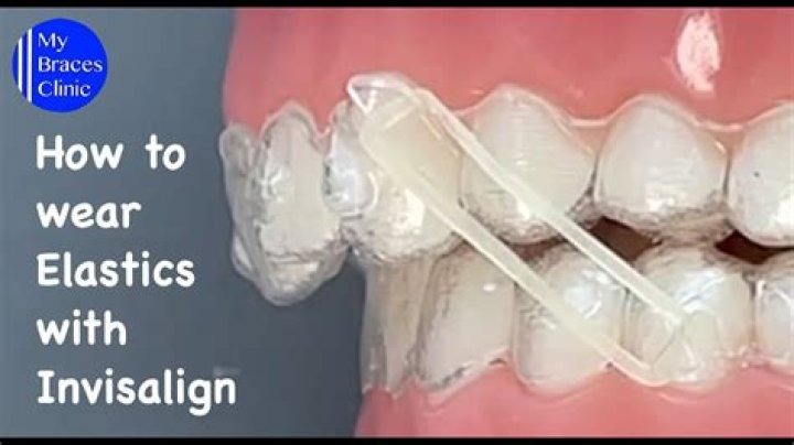 Should i wear elastics while sleeping?