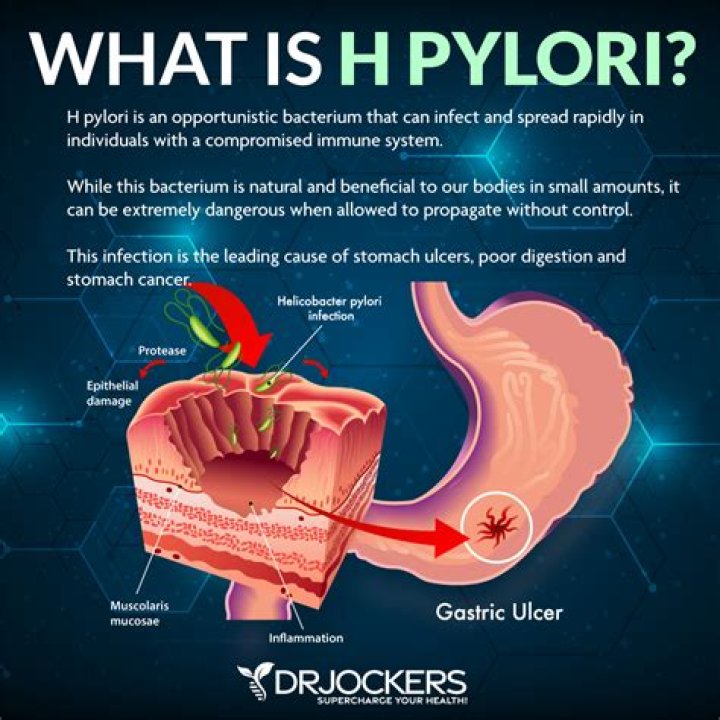 Should you treat helicobacter pylori?