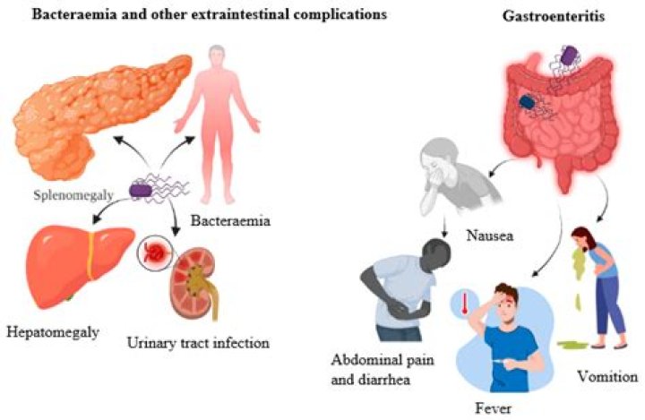 What are symptoms of bacteremia?