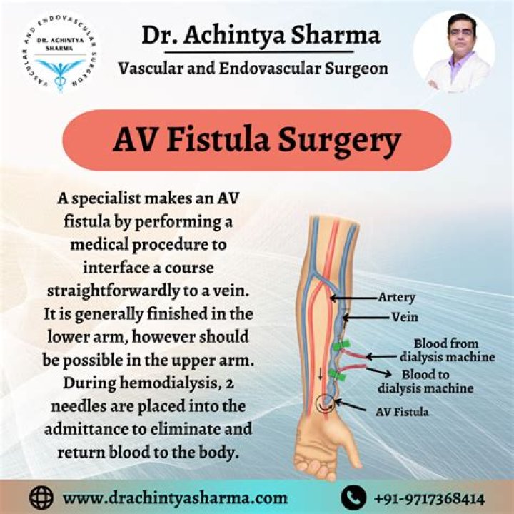 What is arm fistula?