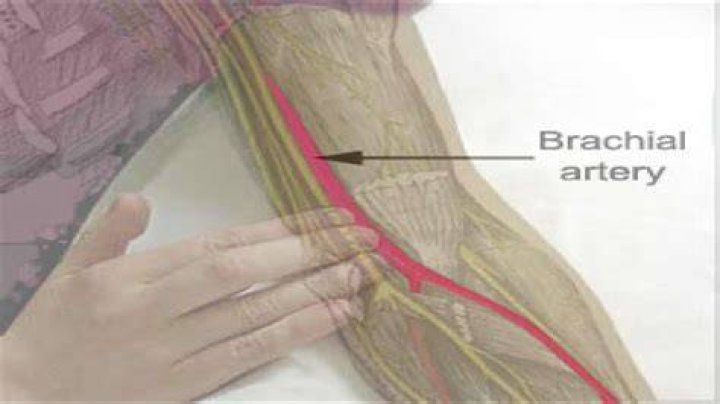 What is brachial artery?