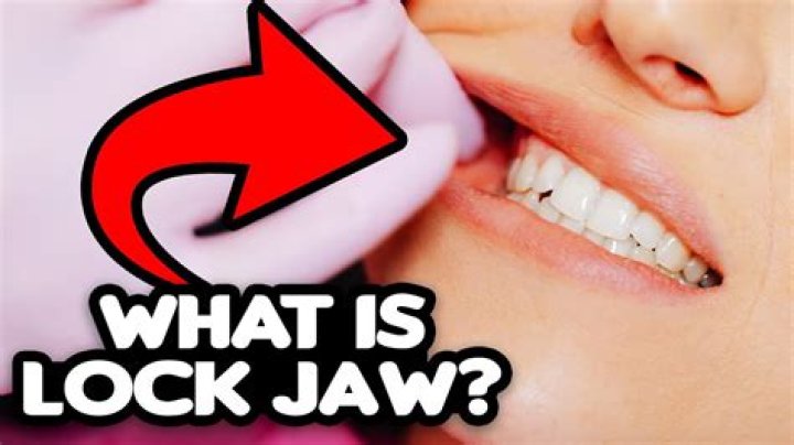 What is locked jaw symptoms?