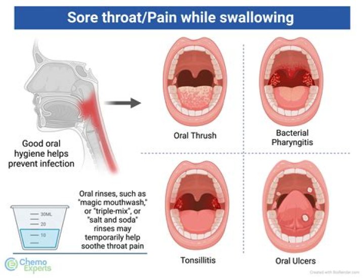 What is scratchy feeling in throat?