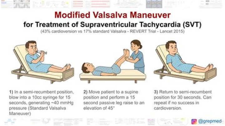 What is vasovagal maneuver?