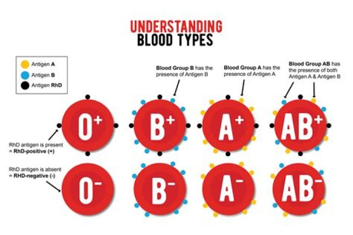 What type of blood is spurting?