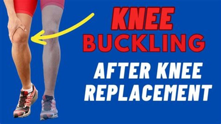 Whats a buckled knee?