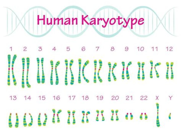 Whats a karyotype chart?