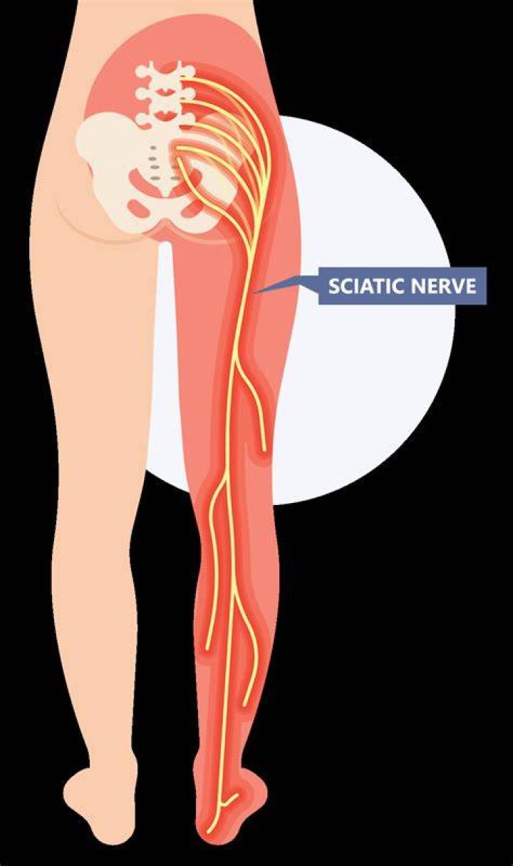 Whats a sciatic nerve?