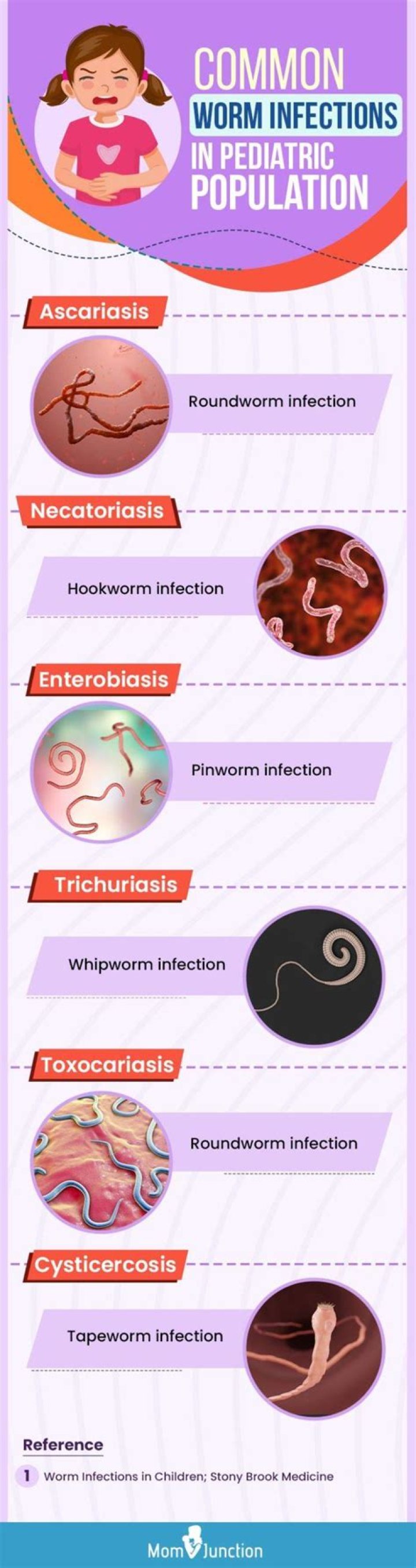 Whats a sign of pinworms?