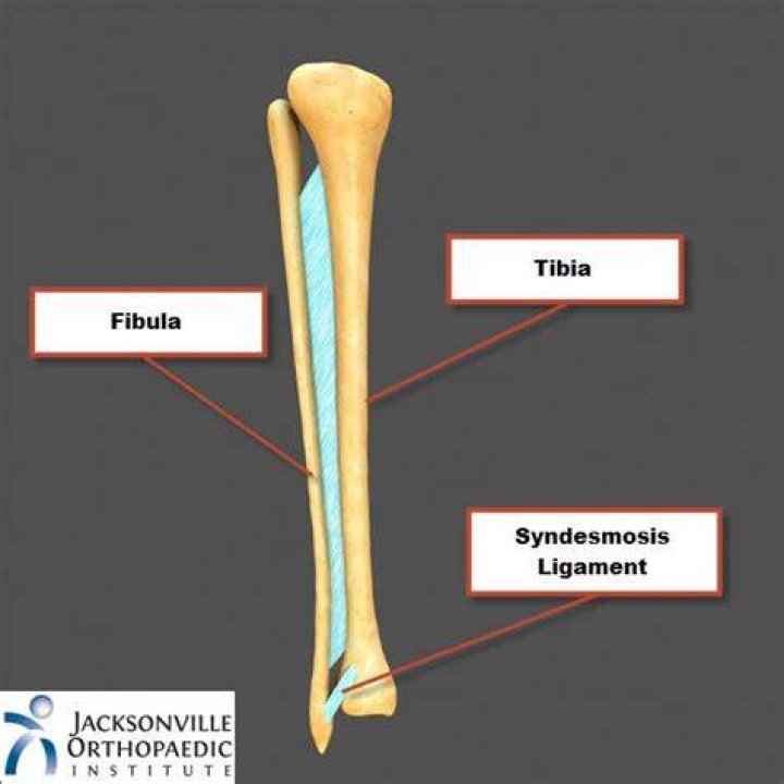 Where are syndesmosis joints found?