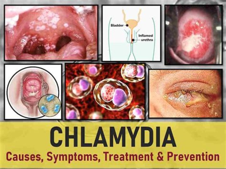 Where do chlamydia come from?