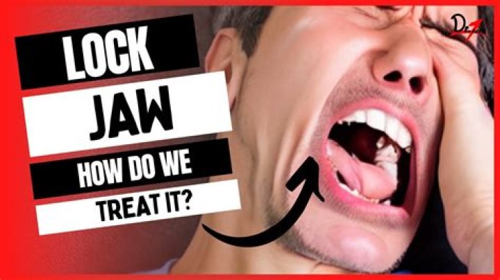 Where do i go for a locked jaw?