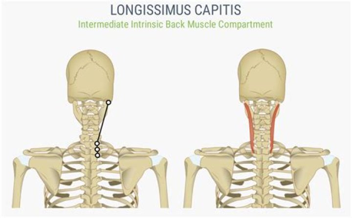 Where is longus capitis?
