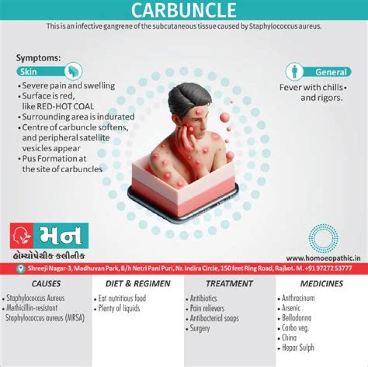 Which bacteria cause carbuncle?
