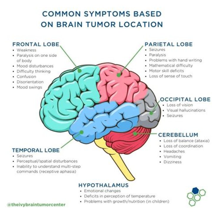 Which brain tumours is highly vascular in nature?