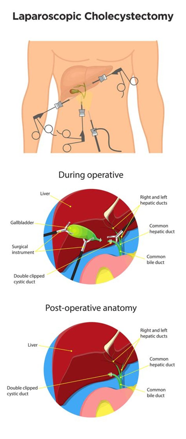 Which doctor to consult for laryngospasm?