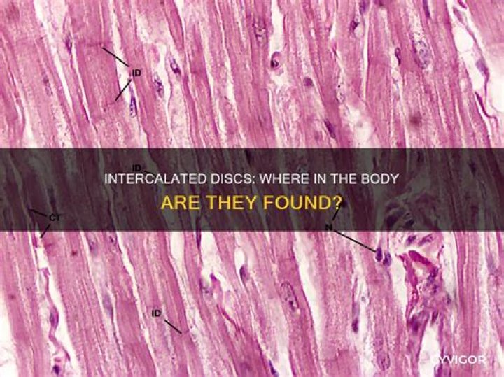 Which muscle contains intercalated discs?