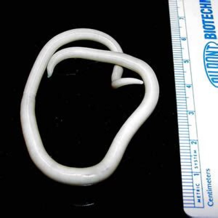 Who discovered ascaris lumbricoides?