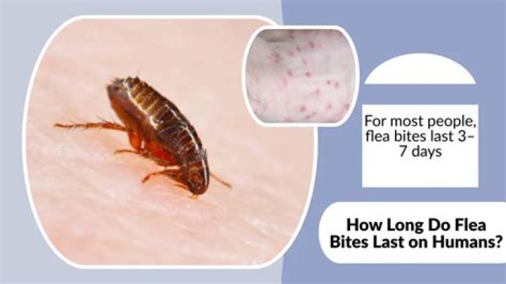 Who long do flea bites last?