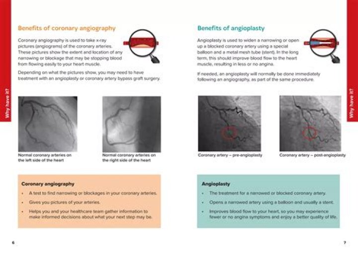 Why angiography is important?