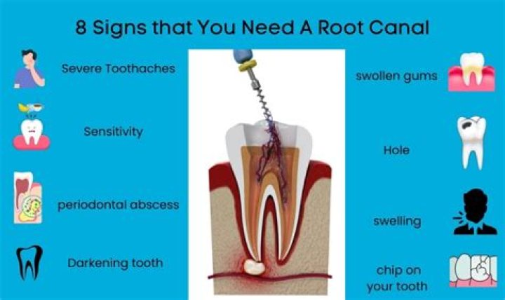 Why do i keep needing root canals?